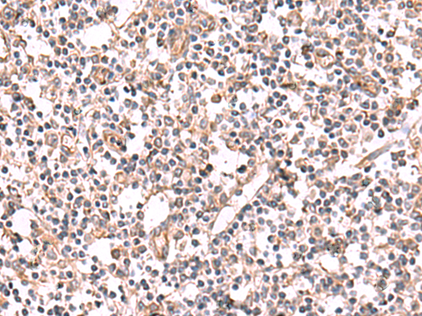Rabbit Polyclonal Antibody to KCNK12