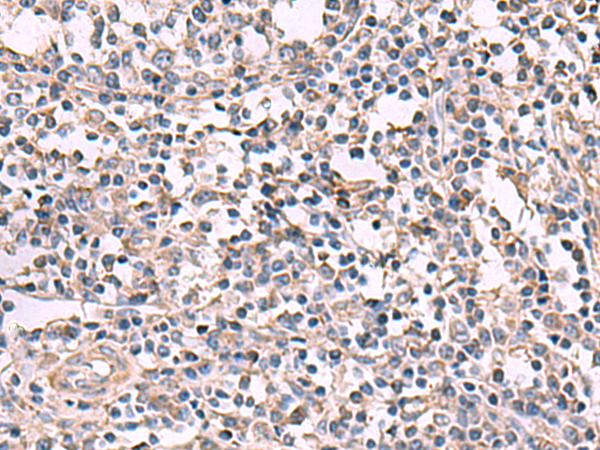 Rabbit Polyclonal Antibody to KCNK18