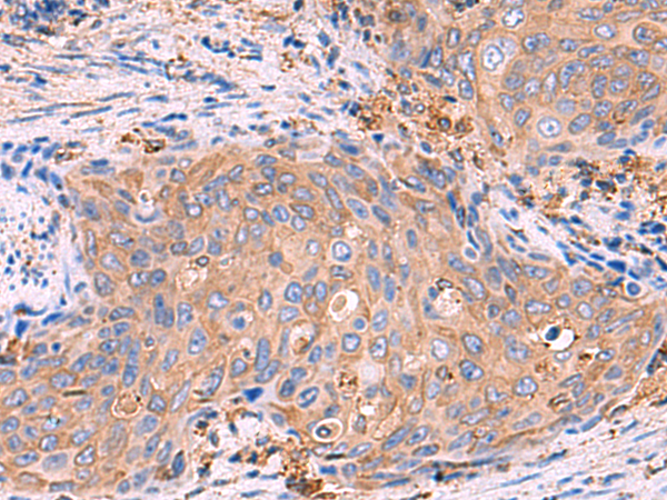 Rabbit Polyclonal Antibody to G6PC1