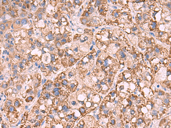 Rabbit Polyclonal Antibody to KCNN1