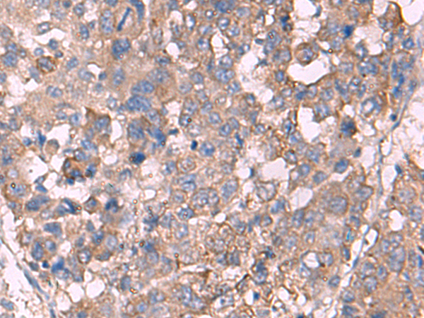 Rabbit Polyclonal Antibody to KCNN3