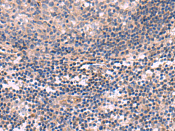 Rabbit Polyclonal Antibody to KCNT1