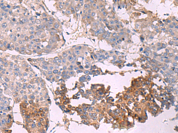 Rabbit Polyclonal Antibody to NIPSNAP1