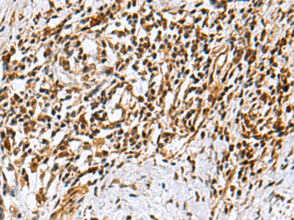 Rabbit Polyclonal Antibody to KDM2B