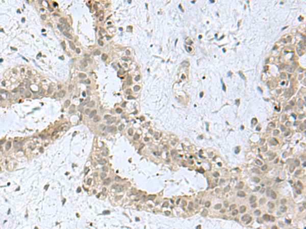 Rabbit Polyclonal Antibody to KDM3B