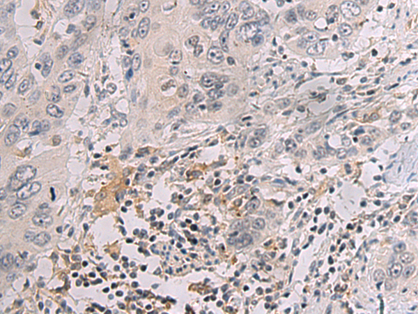 Rabbit Polyclonal Antibody to KRT12