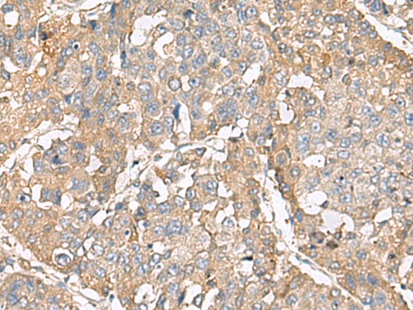 Rabbit Polyclonal Antibody to RBFOX1