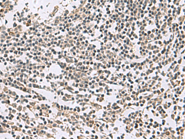 Rabbit Polyclonal Antibody to ABCA10
