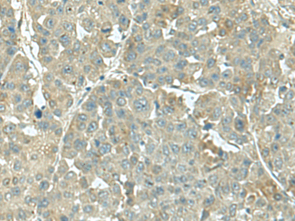 Rabbit Polyclonal Antibody to KRT36