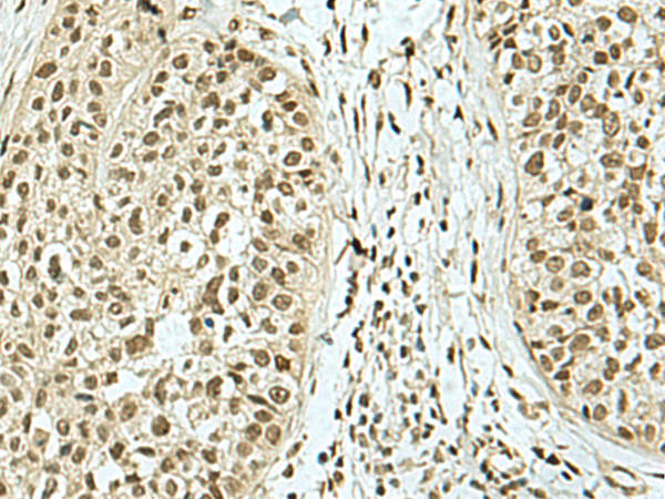 Rabbit Polyclonal Antibody to KHSRP