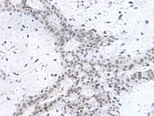 Rabbit Polyclonal Antibody to PCLAF