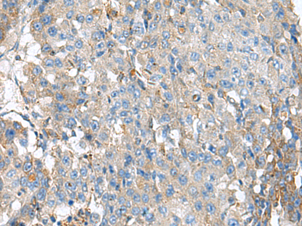 Rabbit Polyclonal Antibody to KIAA0556