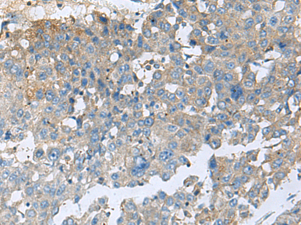 Rabbit Polyclonal Antibody to CEMIP