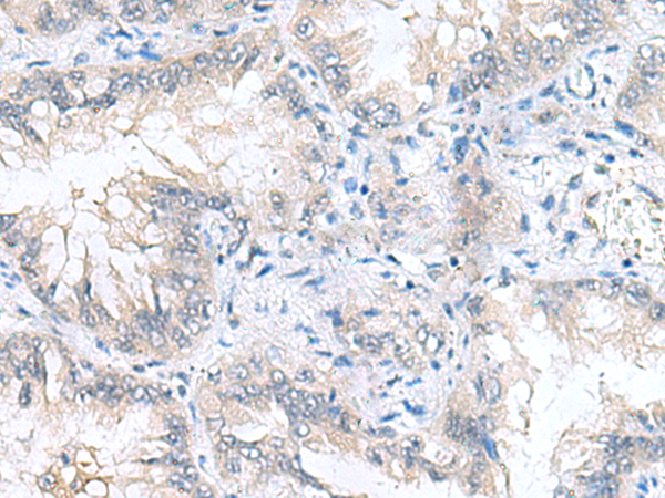 Rabbit Polyclonal Antibody to CAMSAP3