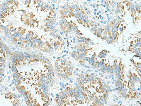 Rabbit Polyclonal Antibody to SHTN1