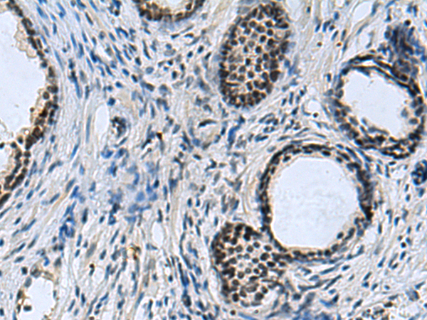 Rabbit Polyclonal Antibody to CCAR2