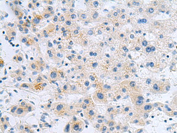 Rabbit Polyclonal Antibody to EARS2