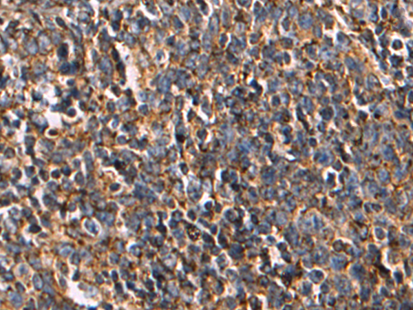 Rabbit Polyclonal Antibody to LAMP1