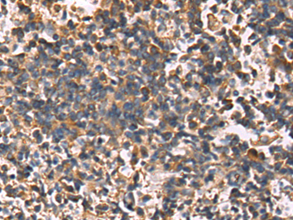 Rabbit Polyclonal Antibody to RPL7