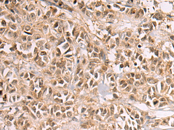 Rabbit Polyclonal Antibody to ESRP1