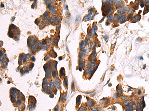 Rabbit Polyclonal Antibody to ARRDC4