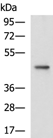 Rabbit Polyclonal Antibody to CKB