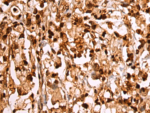 Rabbit Polyclonal Antibody to RUNX1