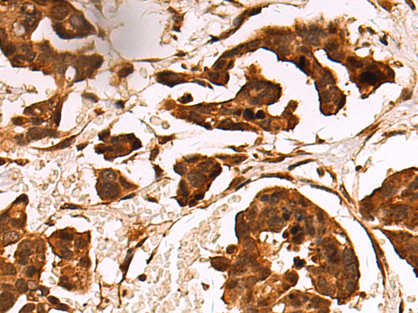 Rabbit Polyclonal Antibody to DNMT3B