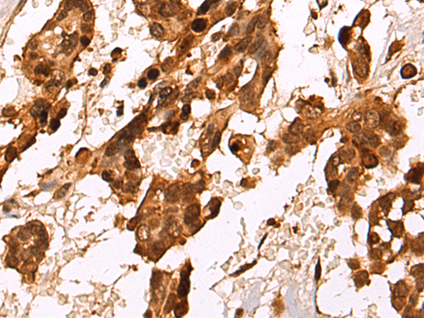 Rabbit Polyclonal Antibody to HDAC7