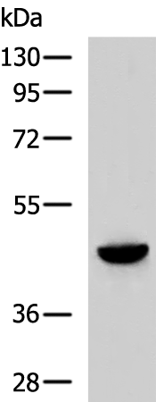 Rabbit Polyclonal Antibody to CKMT1A/CKMT1B