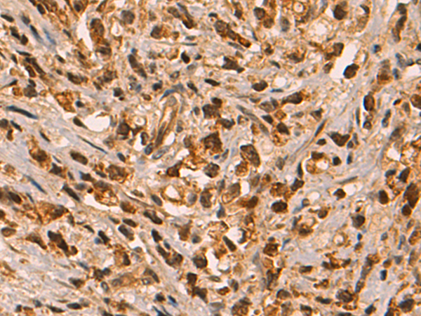 Rabbit Polyclonal Antibody to PAX5