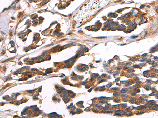 Rabbit Polyclonal Antibody to PIWIL2