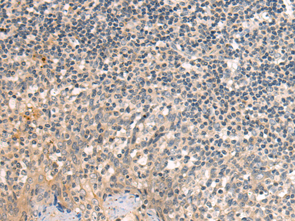Rabbit Polyclonal Antibody to CASP3(active)