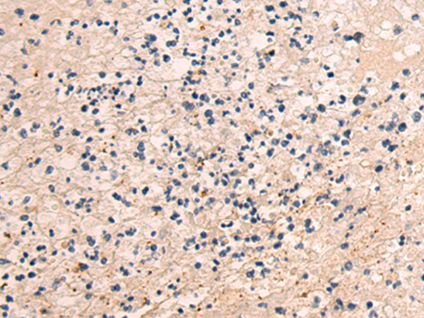 Rabbit Polyclonal Antibody to IAPP