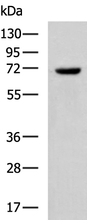 Rabbit Polyclonal Antibody to SLC28A1