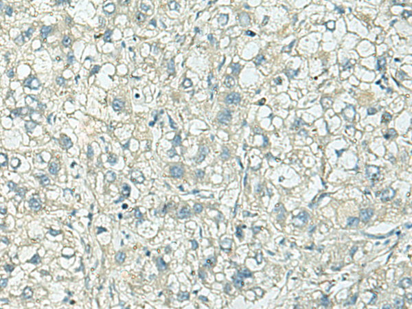 Rabbit Polyclonal Antibody to KIF3B