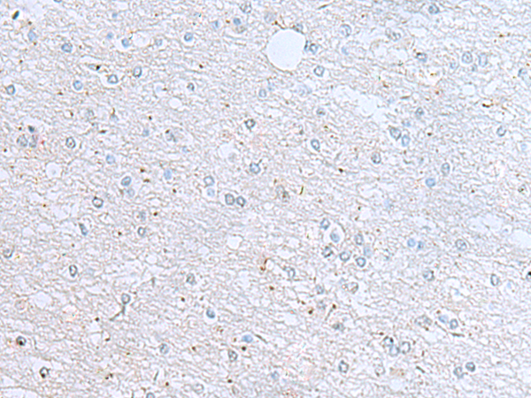 Rabbit Polyclonal Antibody to KIF5A