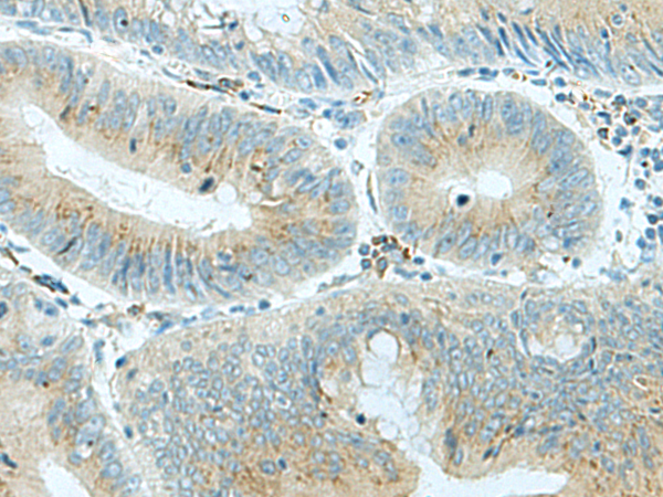 Rabbit Polyclonal Antibody to KIF5C