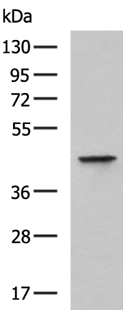 Rabbit Polyclonal Antibody to KNG1