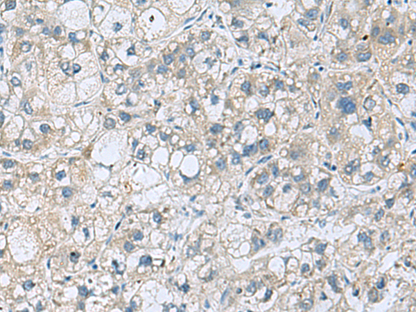 Rabbit Polyclonal Antibody to KCNJ2