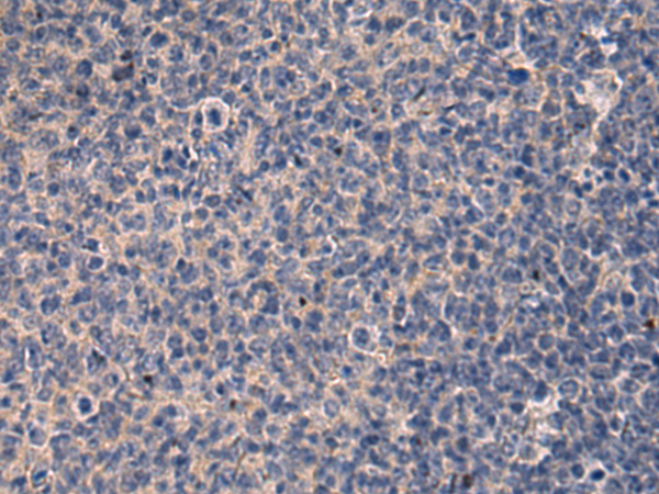 Rabbit Polyclonal Antibody to KRTAP1-1