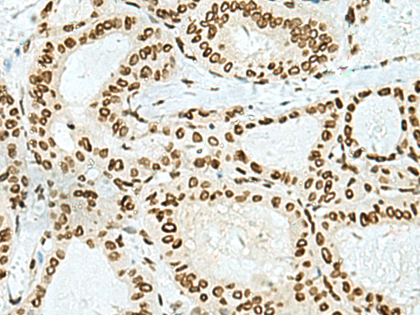 Rabbit Polyclonal Antibody to HOXC9