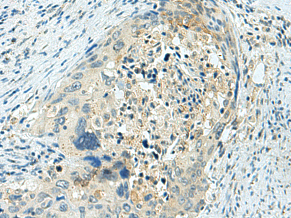 Rabbit Polyclonal Antibody to HSPB11