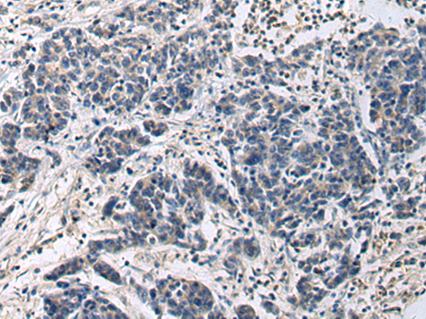 Rabbit Polyclonal Antibody to CNTF