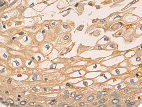 Rabbit Polyclonal Antibody to PLPP2