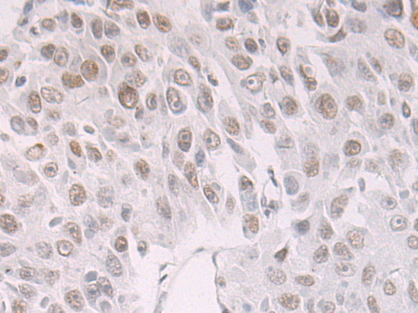 Rabbit Polyclonal Antibody to BCLAF1