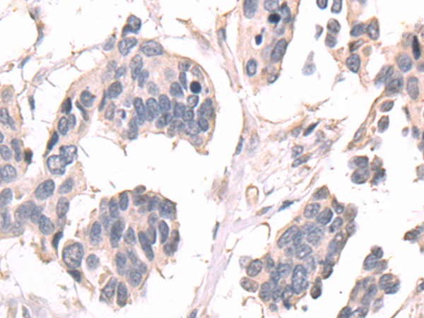 Rabbit Polyclonal Antibody to B4GALT3