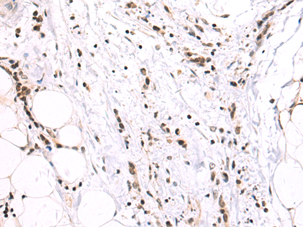 Rabbit Polyclonal Antibody to XRCC1