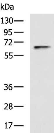 Rabbit Polyclonal Antibody to ESR1