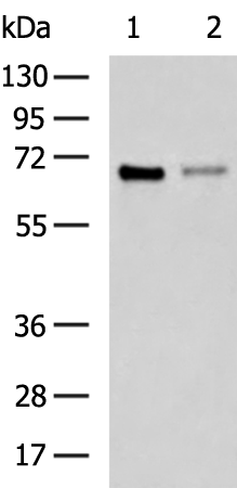Rabbit Polyclonal Antibody to ESR1
